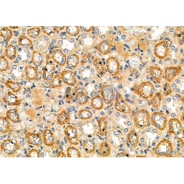LDHA Antibody - DF6280 at 1/100 staining Rat kidney tissue by IHC-P.
