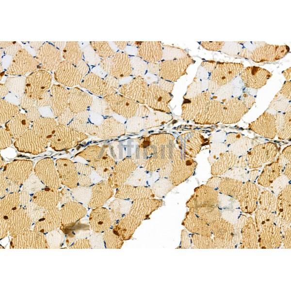 LDHA Antibody - DF6280 at 1/100 staining Rat skin tissue by IHC-P.