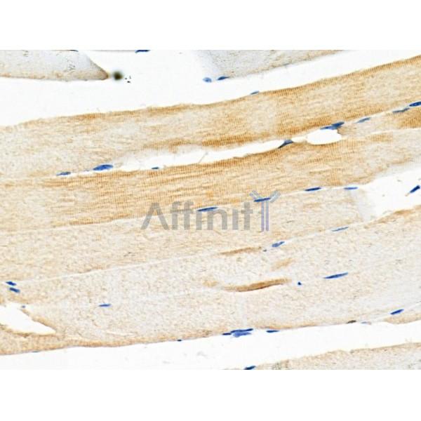 ADIPOR1 Antibody - DF6430 at 1/100 staining Mouse muscle tissue by IHC-P.