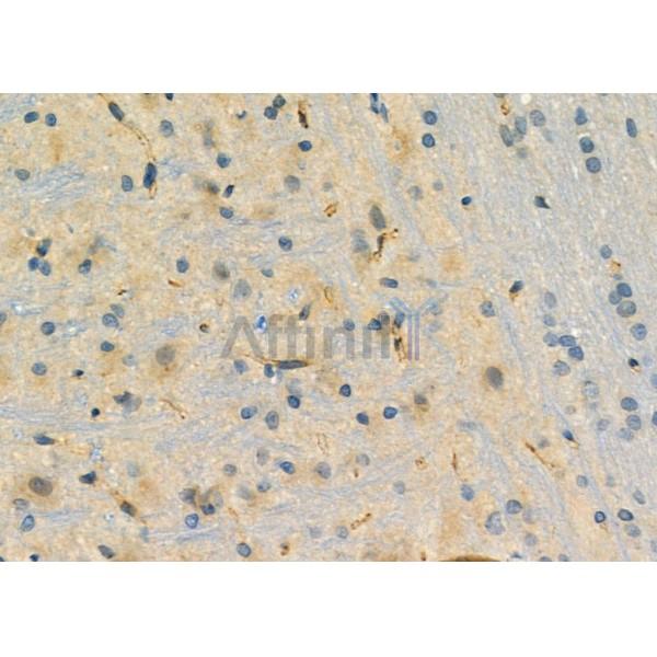 DHFR Antibody - DF6495 at 1/100 staining Rat brain tissue by IHC-P.