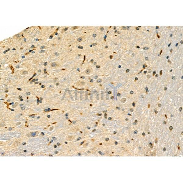 NR0B1 Antibody - DF6585 at 1/100 staining Mouse brain tissue by IHC-P.