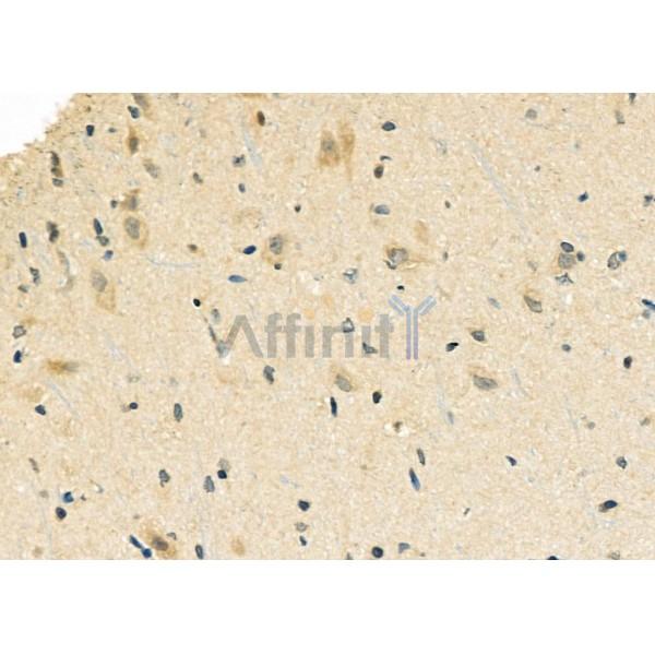 NR0B1 Antibody - DF6585 at 1/100 staining Rat brain tissue by IHC-P.