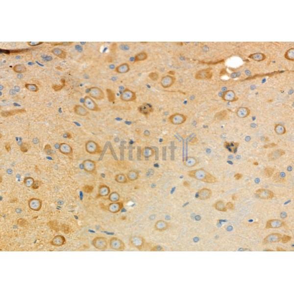 VIP Antibody - DF6627 at 1/100 staining Rat brain tissue by IHC-P.