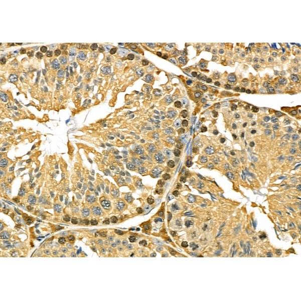 IKZF1 Antibody - DF6659 at 1/100 staining Mouse testis tissue by IHC-P.