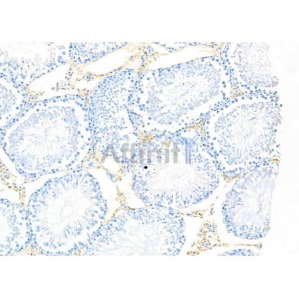 CADM1 Antibody - DF6679 at 1/100 staining Rat testis tissue by IHC-P.