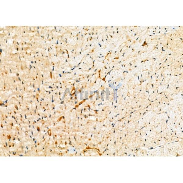 RAB27A Antibody - DF6702 at 1/100 staining Mouse heart tissue by IHC-P.