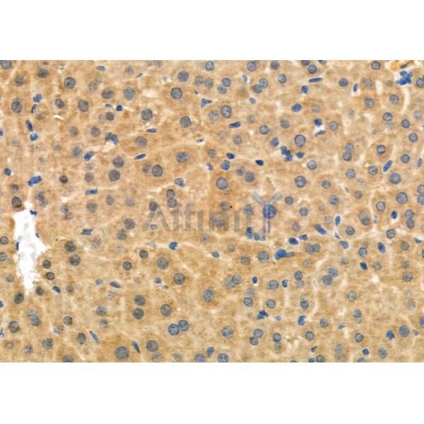 RAB27A Antibody - DF6702 at 1/100 staining Mouse liver tissue by IHC-P.