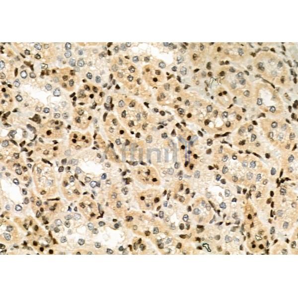 POLI Antibody - DF6707 at 1/100 staining Rat kidney tissue by IHC-P.