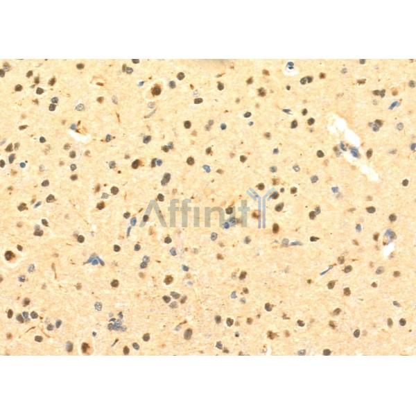 NOX4 Antibody - DF6924 at 1/100 staining Mouse brain tissue by IHC-P.