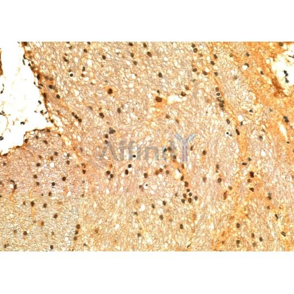 NOX4 Antibody - DF6924 at 1/100 staining Rat brain tissue by IHC-P.