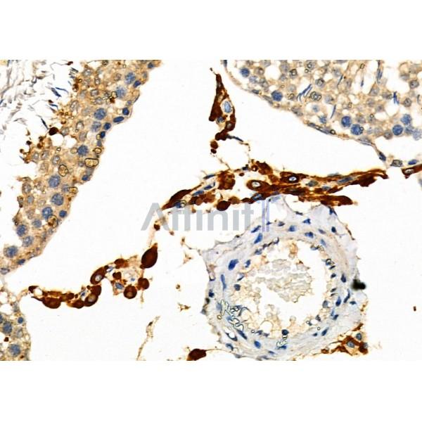 CASK Antibody - DF6970 at 1/100 staining Rat testis tissue by IHC-P.