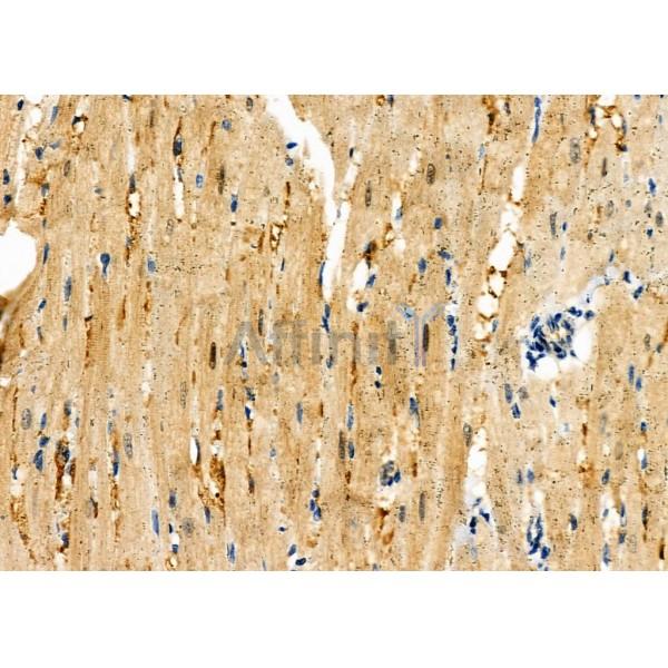 CASK Antibody - DF6970 at 1/100 staining Rat heart tissue by IHC-P.