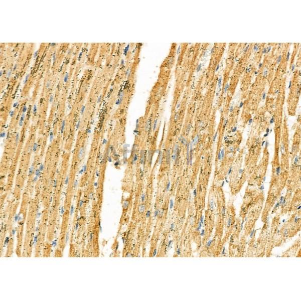 SERPINH1 Antibody - DF6980 at 1/100 staining Rat heart tissue by IHC-P.