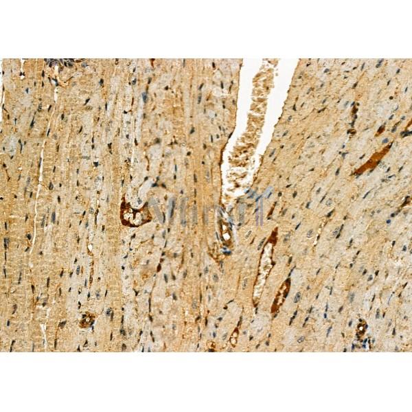 DKK3 Antibody - DF6988 at 1/100 staining Mouse heart tissue by IHC-P.