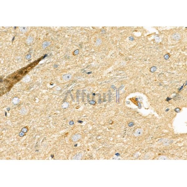DKK3 Antibody - DF6988 at 1/100 staining Rat brain tissue by IHC-P.