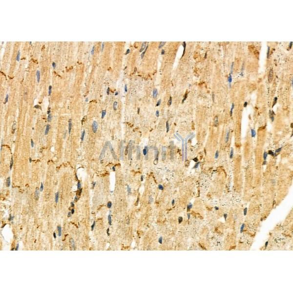 IGFBP1 Antibody - DF7130 at 1/100 staining Rat heart tissue by IHC-P.