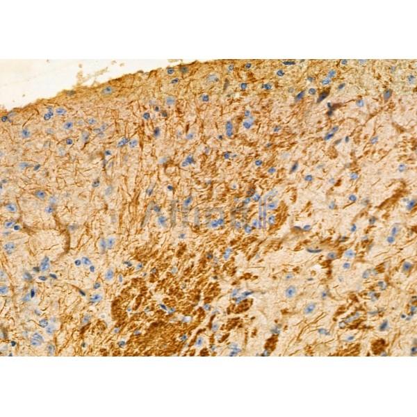 KLK5 Antibody - DF7137 at 1/100 staining Mouse brain tissue by IHC-P.
