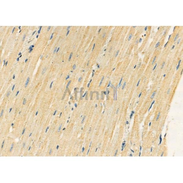 KLK5 Antibody - DF7137 at 1/100 staining Rat heart tissue by IHC-P.