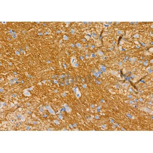 KLK5 Antibody - DF7137 at 1/100 staining Rat brain tissue by IHC-P.