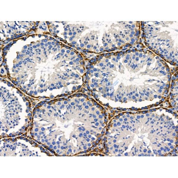 PDX1 Antibody - DF7170 at 1/100 staining Mouse testis tissue by IHC-P.