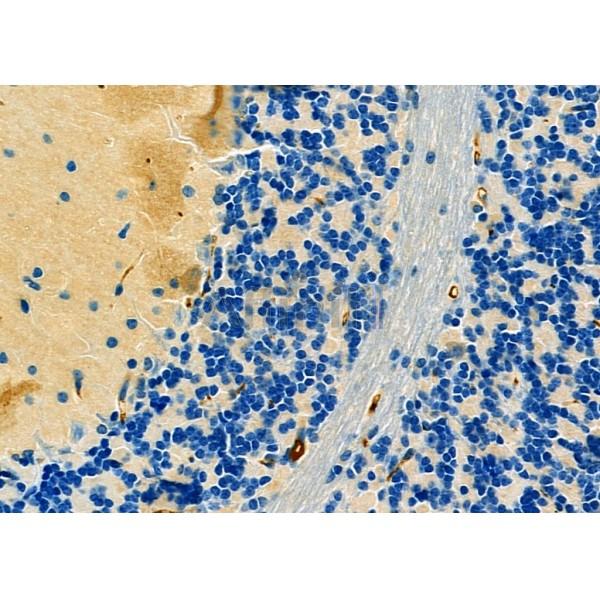 GM130 Antibody - DF7286 at 1/100 staining Mouse brain tissue by IHC-P.