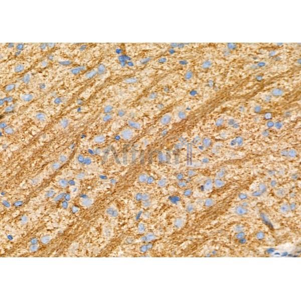 MOG Antibody - DF7294 at 1/100 staining Rat brain tissue by IHC-P.