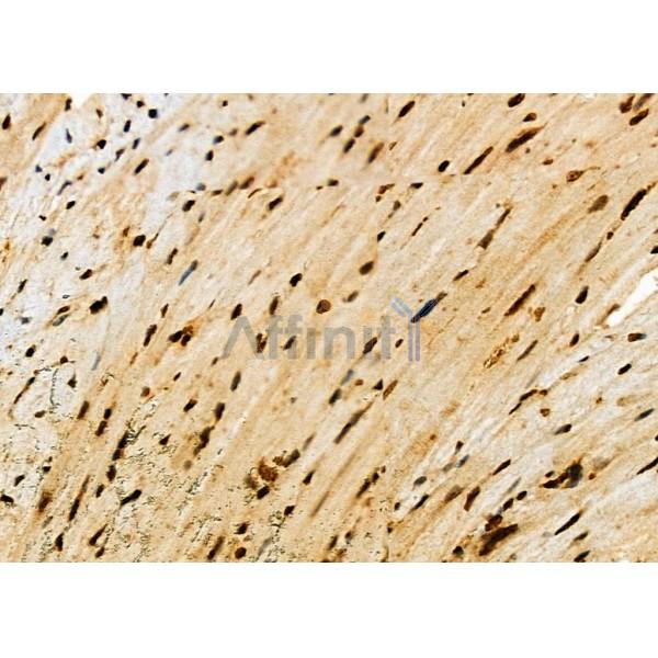 NDC80 Antibody - DF7329 at 1/100 staining Mouse heart tissue by IHC-P.