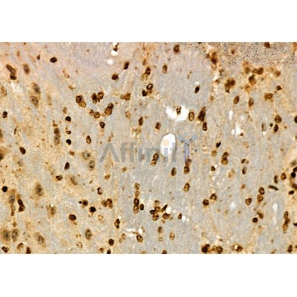 NDC80 Antibody - DF7329 at 1/100 staining Mouse brain tissue by IHC-P.