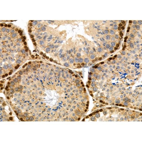 NDC80 Antibody - DF7329 at 1/100 staining Mouse testis tissue by IHC-P.