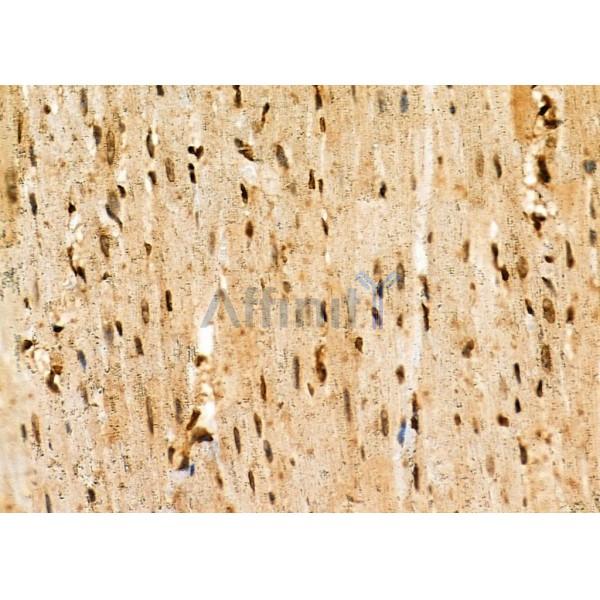 NDC80 Antibody - DF7329 at 1/100 staining Rat heart tissue by IHC-P.