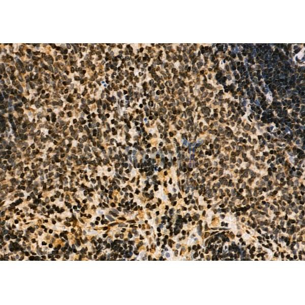 NDC80 Antibody - DF7329 at 1/100 staining Rat spleen tissue by IHC-P.