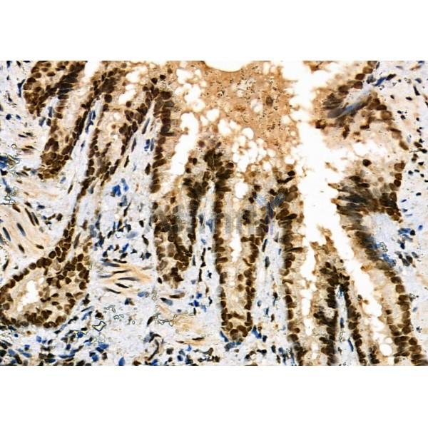 NDC80 Antibody - DF7329 at 1/100 staining Rat lung tissue by IHC-P.