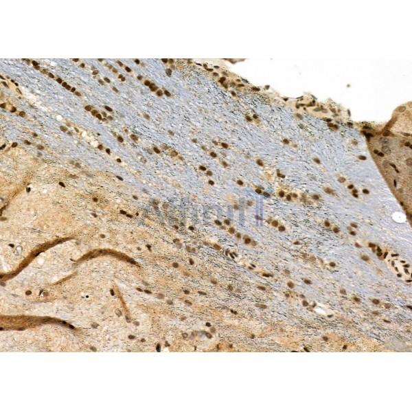 NDC80 Antibody - DF7329 at 1/100 staining Rat brain tissue by IHC-P.