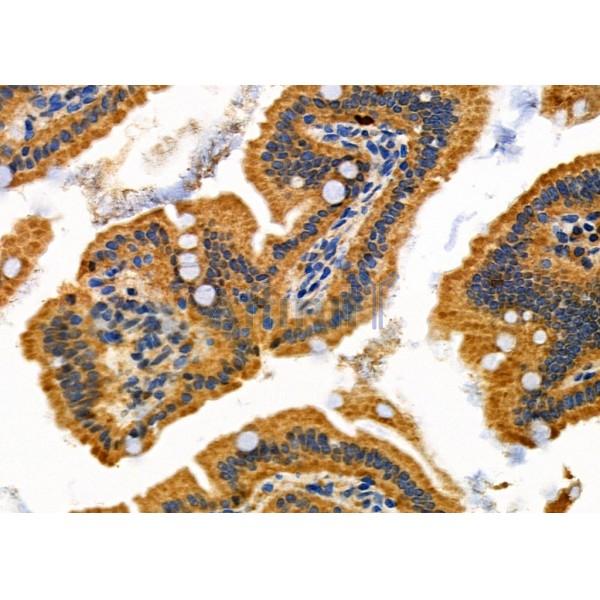 AGO1 Antibody - DF7542 at 1/100 staining Mouse colorectal tissue by IHC-P.