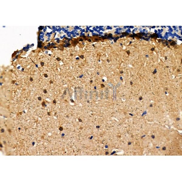 Parvalbumin Antibody - DF7544 at 1/100 staining Mouse brain tissue by IHC-P.