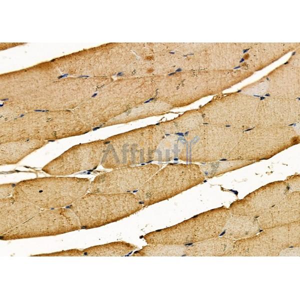 Parvalbumin Antibody - DF7544 at 1/100 staining Mouse muscle tissue by IHC-P.