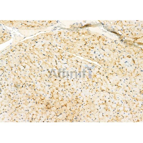 Caveolin 3 Antibody - DF7547 at 1/100 staining Rat heart tissue by IHC-P.