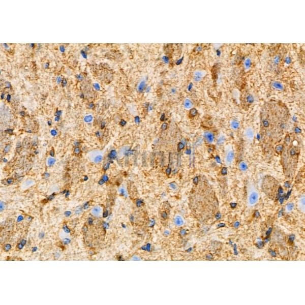 Calretinin Antibody - DF7586 at 1/100 staining Mouse brain tissue by IHC-P.