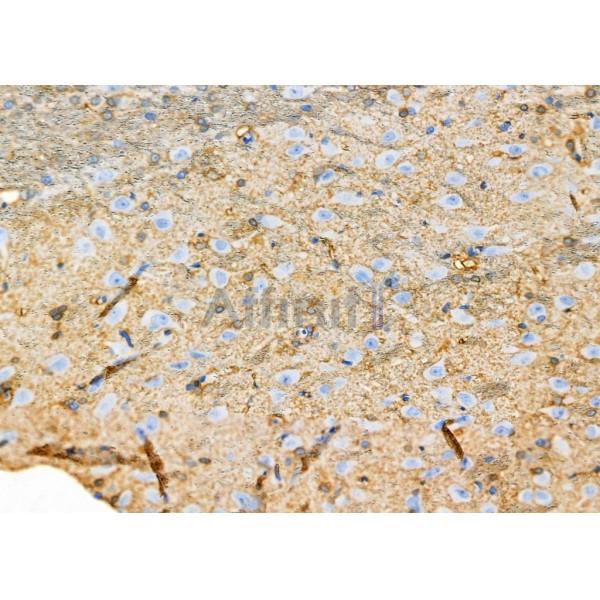 Calretinin Antibody - DF7586 at 1/100 staining Rat brain tissue by IHC-P.
