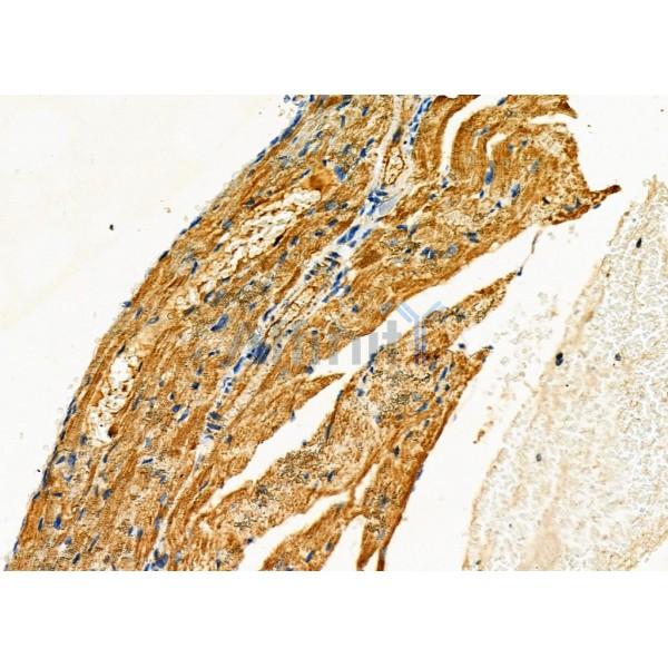 TRIM29 Antibody - DF8050 at 1/100 staining Mouse heart tissue by IHC-P.