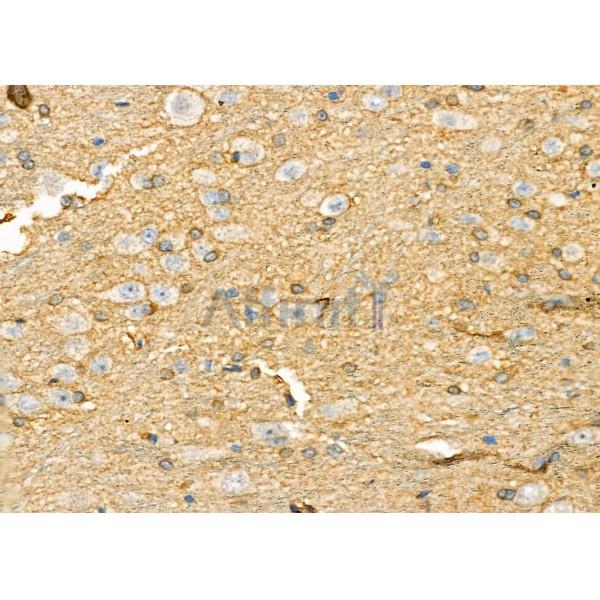 TRIM29 Antibody - DF8050 at 1/100 staining Rat brain tissue by IHC-P.