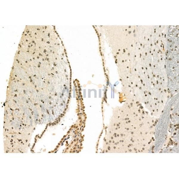BNIP3L Antibody - DF8163 at 1/100 staining Mouse brain tissue by IHC-P.