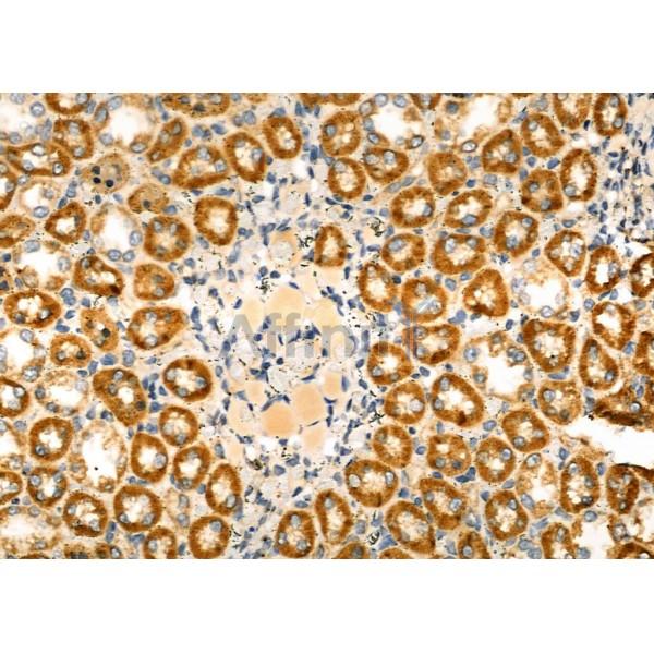 ENaC gamma Antibody - DF8540 at 1/100 staining Rat kidney tissue by IHC-P.