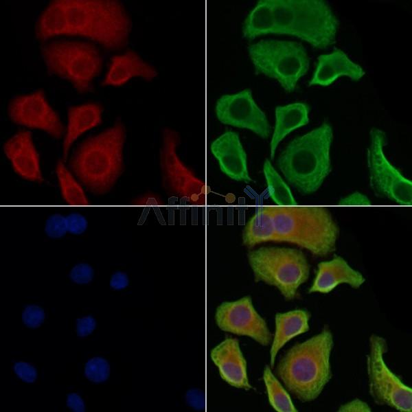 Phospho-MEKK1 (Thr1402)[Thr1400] Antibody - DF8741 staining Hela cells(heat shock treatment) by IF/ICC.