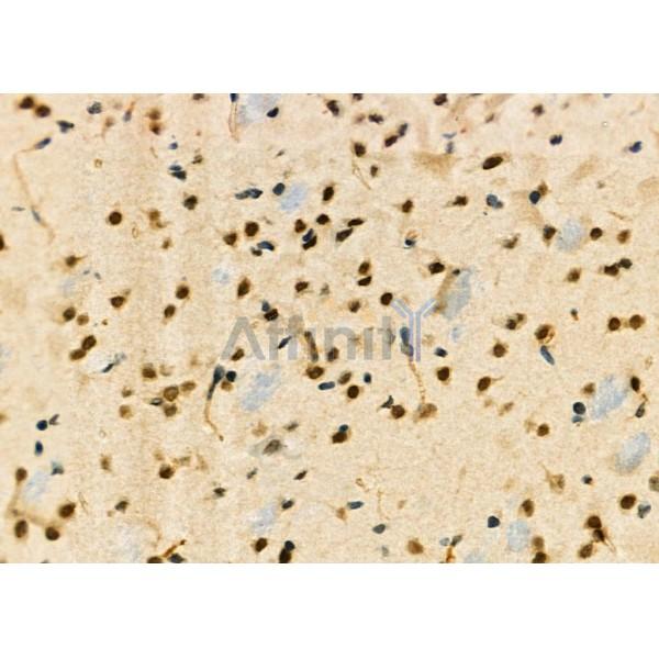 ELP3 Antibody - DF9496 at 1/100 staining Mouse brain tissue by IHC-P.