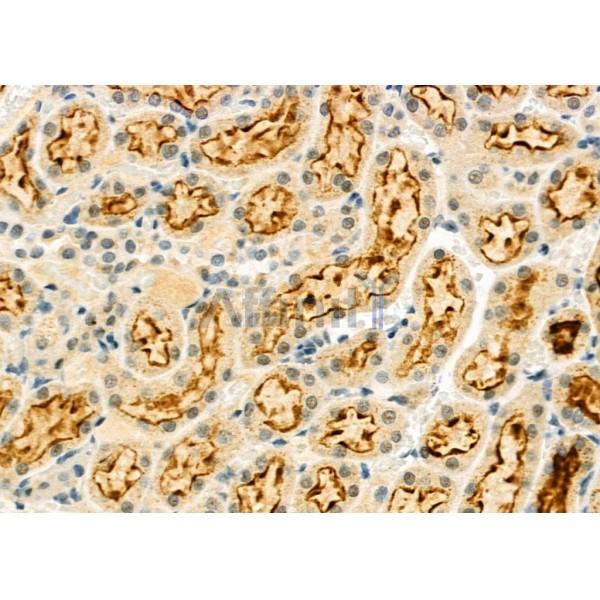 ELP3 Antibody - DF9496 at 1/100 staining Rat kidney tissue by IHC-P.
