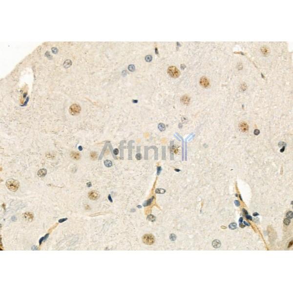 ELP3 Antibody - DF9496 at 1/100 staining Rat brain tissue by IHC-P.