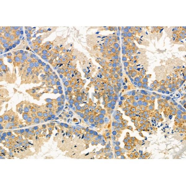 PIM2 Antibody - DF9887 at 1/100 staining Mouse testis tissue by IHC-P.