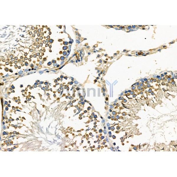 PIM2 Antibody - DF9887 at 1/100 staining Rat testis tissue by IHC-P.