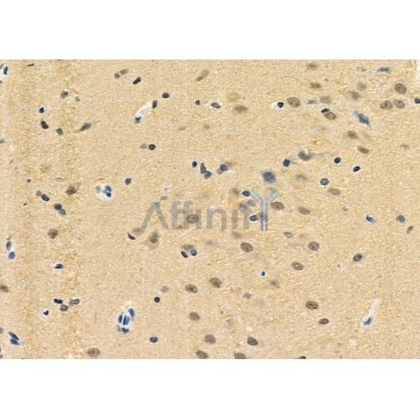 LMX1B Antibody - AF0341 at 1/100 staining Rat brain tissue by IHC-P.